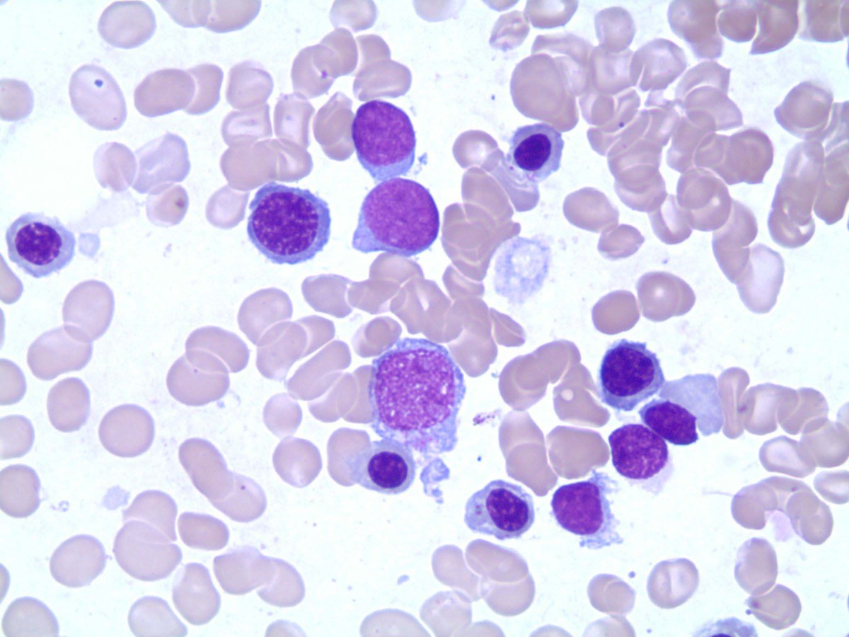 Smear with blasts 1000x